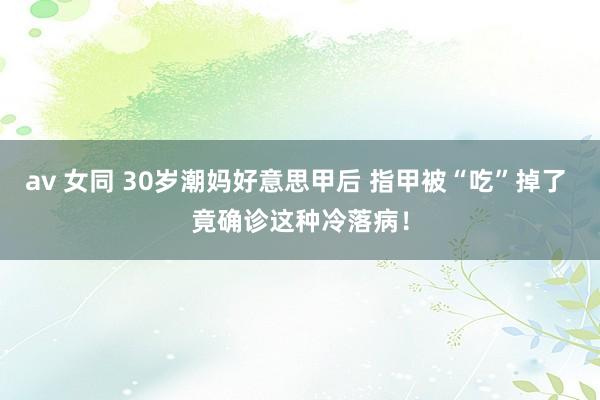 av 女同 30岁潮妈好意思甲后 指甲被“吃”掉了 竟确诊这种冷落病！